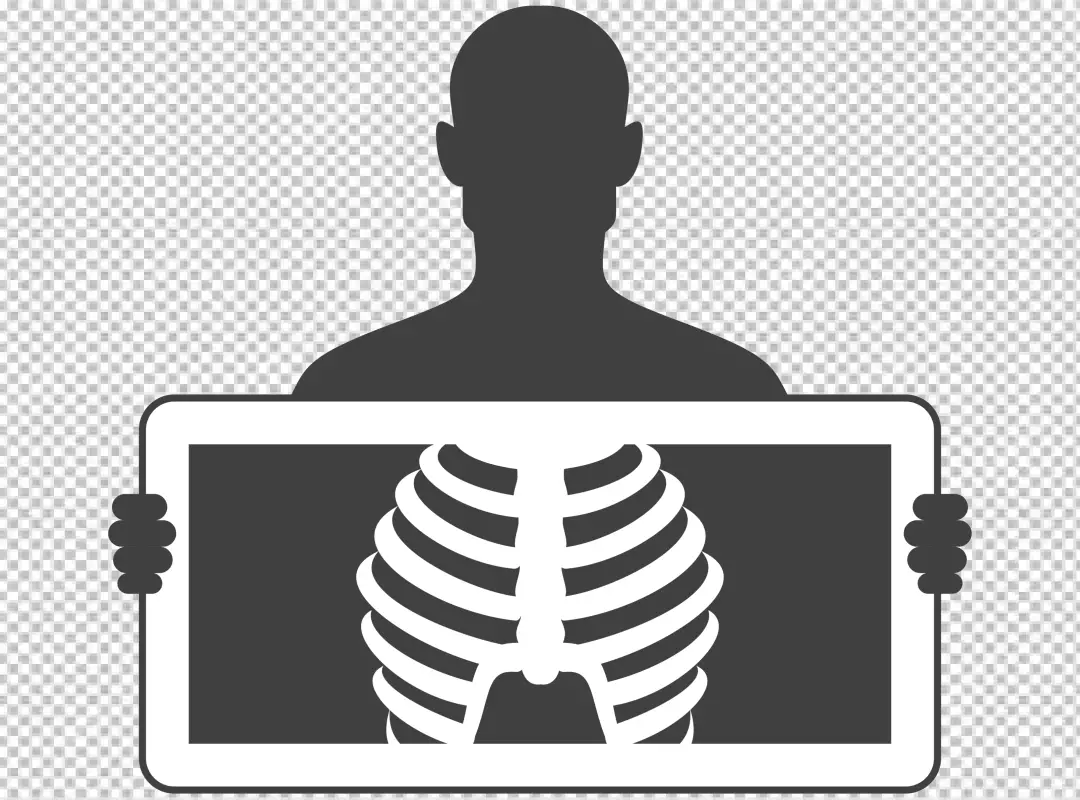 Free Premium PNG X-ray of a Human chest