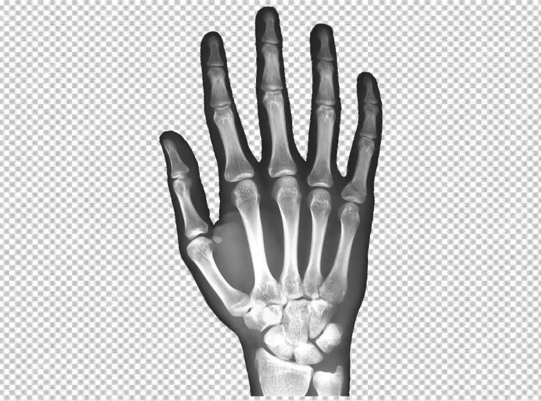 Free Premium PNG X-ray of a Human Hand