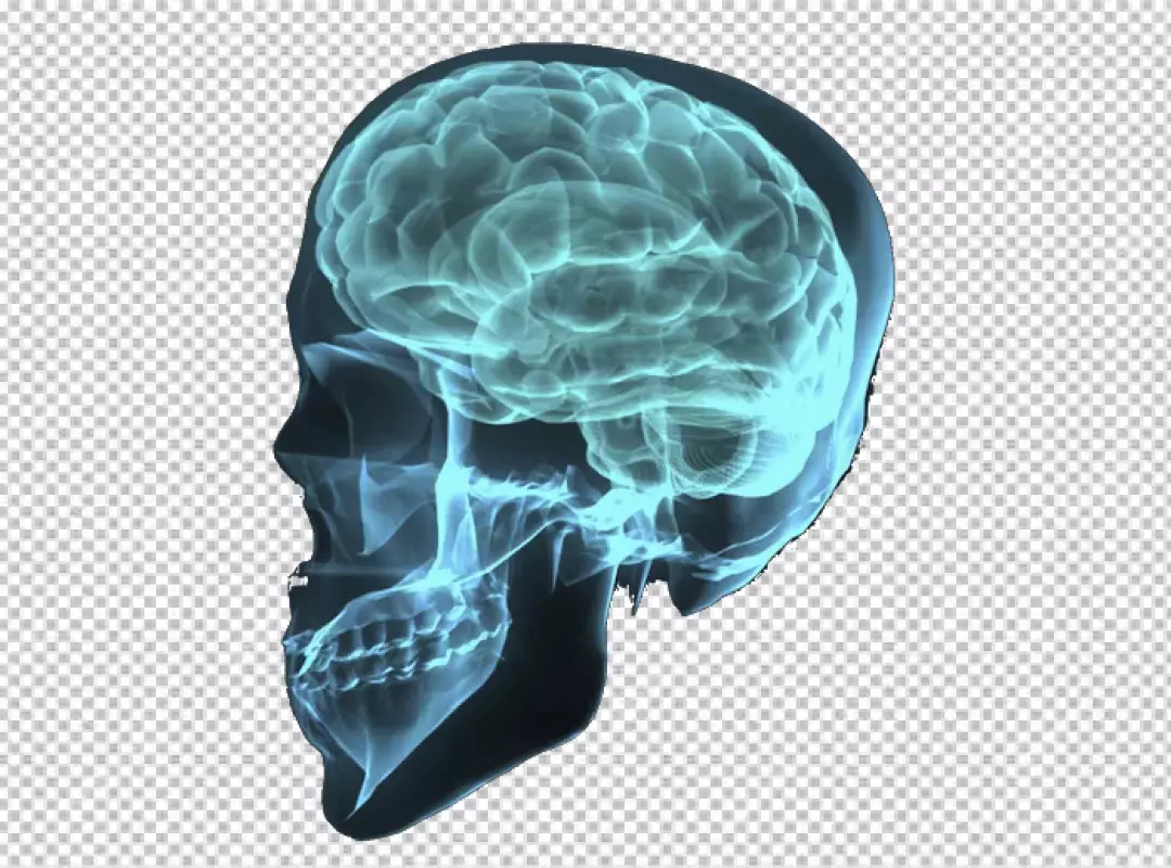 Free Premium PNG X-ray of a Human Head