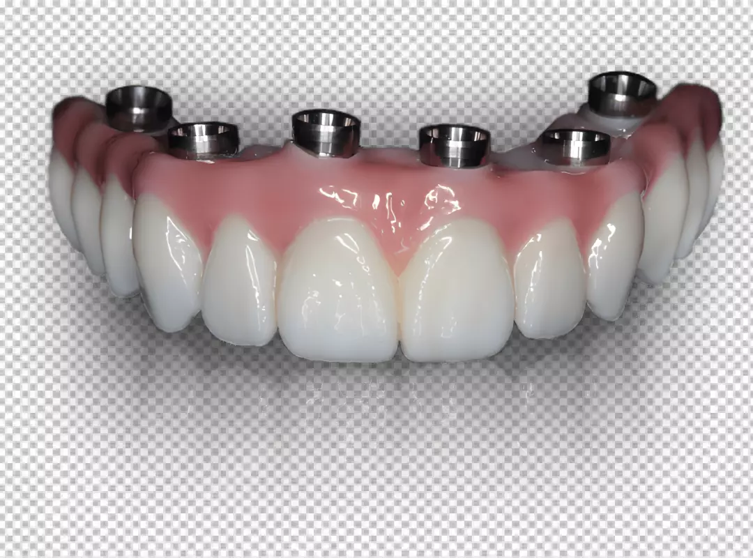 Free Premium PNG a dental prosthesis, which is a false tooth that is used to replace one or more missing teeth