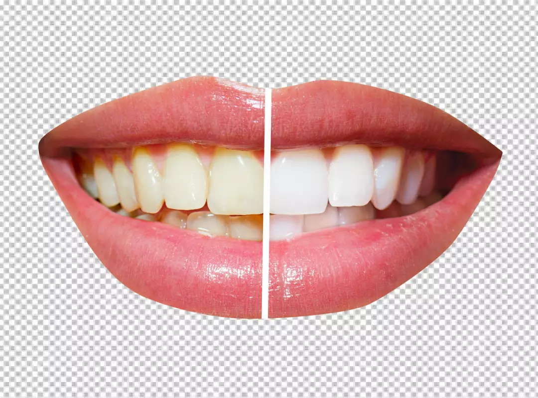 Free Premium PNG a woman's smile with yellow teeth on one side and white teeth on the other side